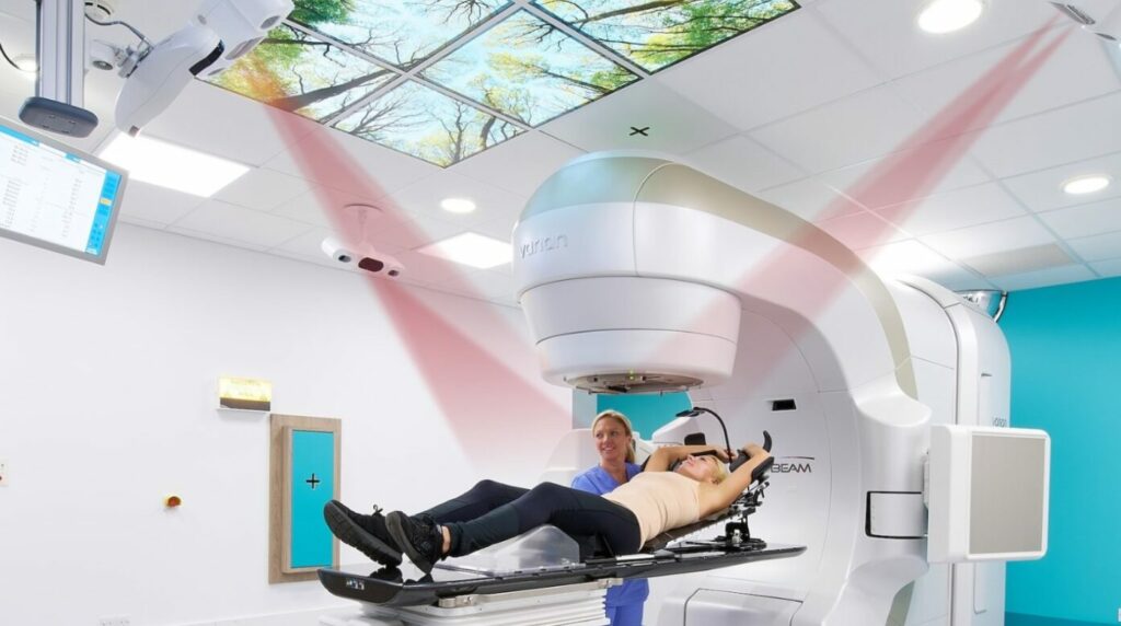 Surface Guided Radiation Therapy